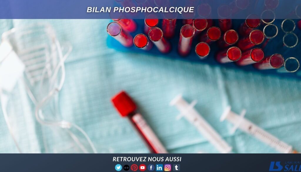 Pourquoi faire un bilan phosphocalcique et comment interpréter les résultats ?