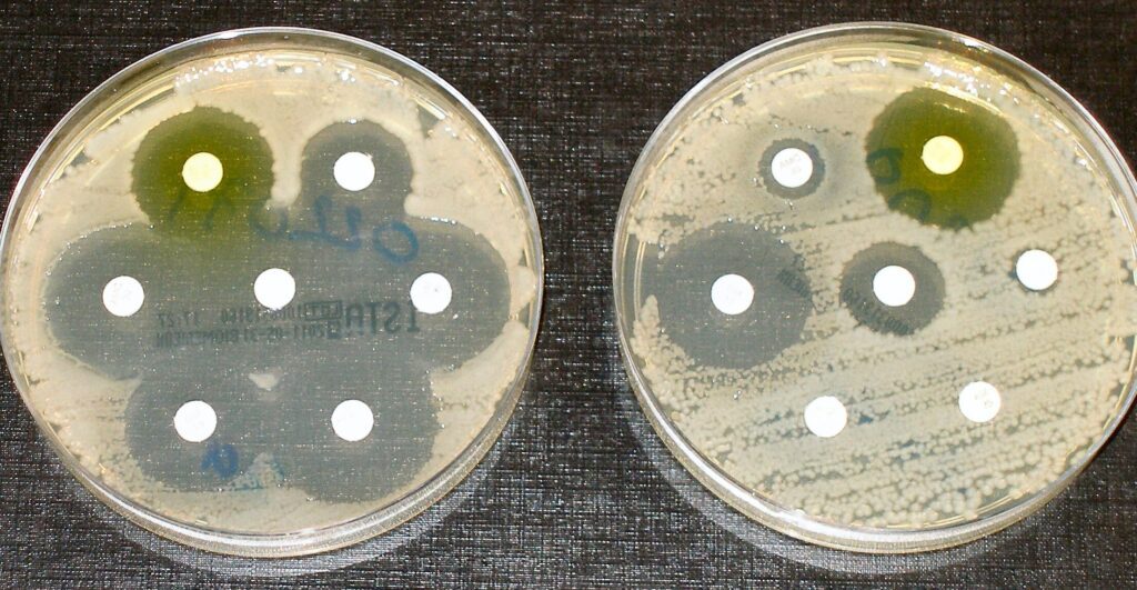 Combien de temps les antibiotiques restent-ils dans le corps ?