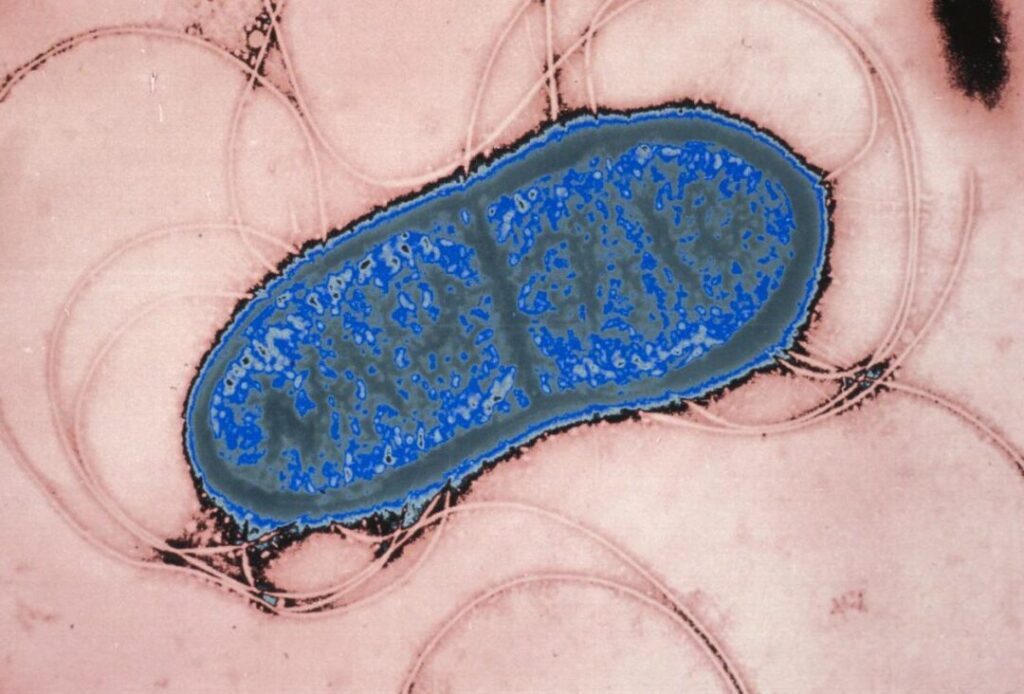 Serratia marcescens : comment cette bactérie affecte-t-elle notre santé ?