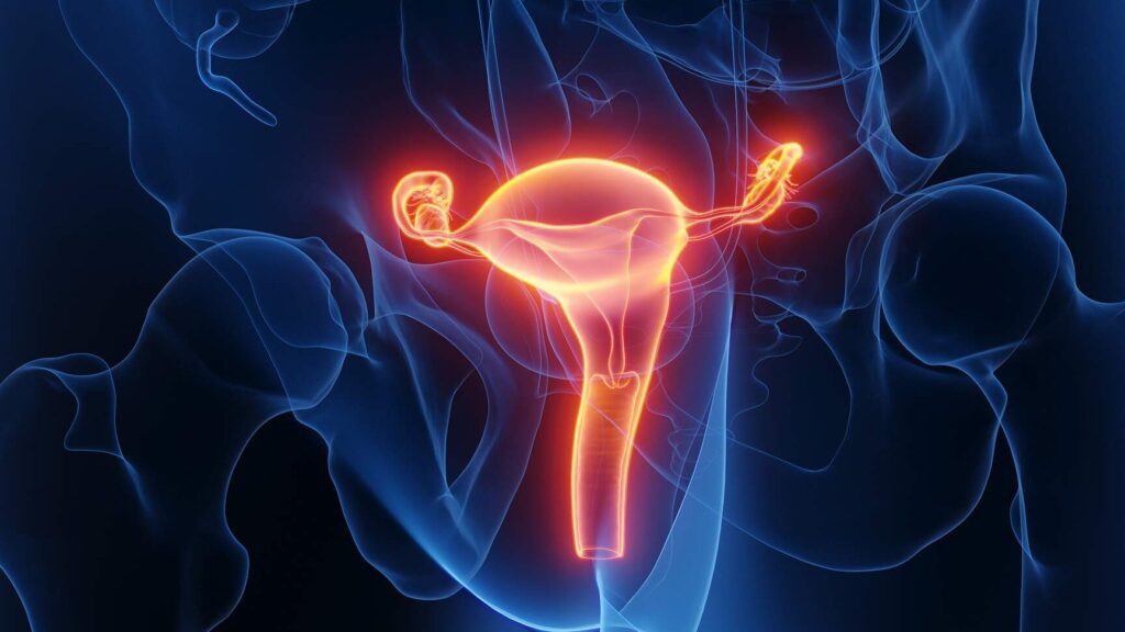 Comprendre et identifier les signes à travers une photo : cancer de l’utérus décrypté