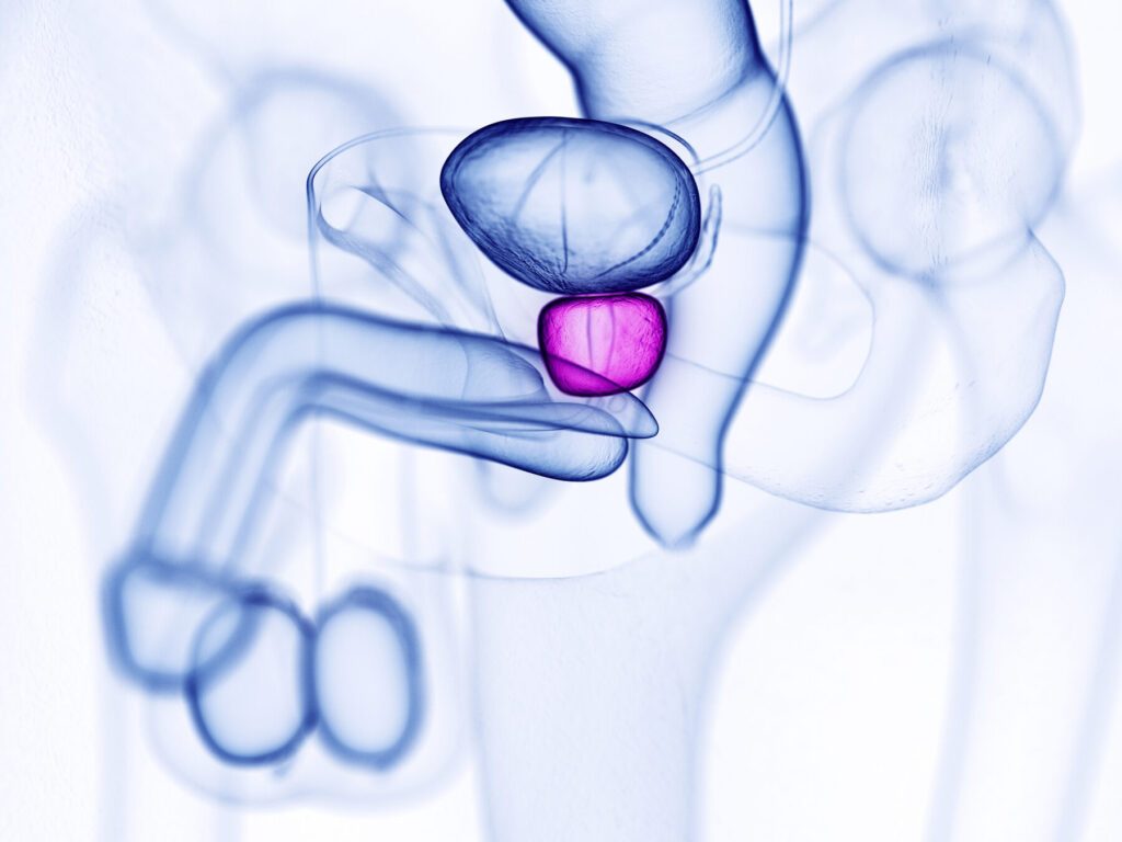 Quels sont les signes visuels du cancer des testicules ? Photos et explications