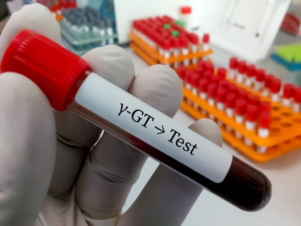 Comprendre votre bilan hépatique complet : quels tests et pourquoi ?