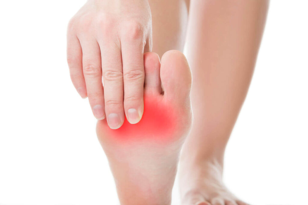 Comment soigner une fracture du 5ème métatarse efficacement ?