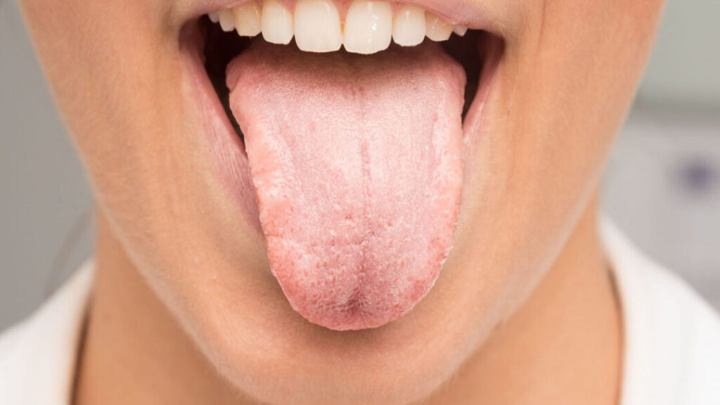 Comprendre le rôle du nerf glosso-pharyngien dans notre corps