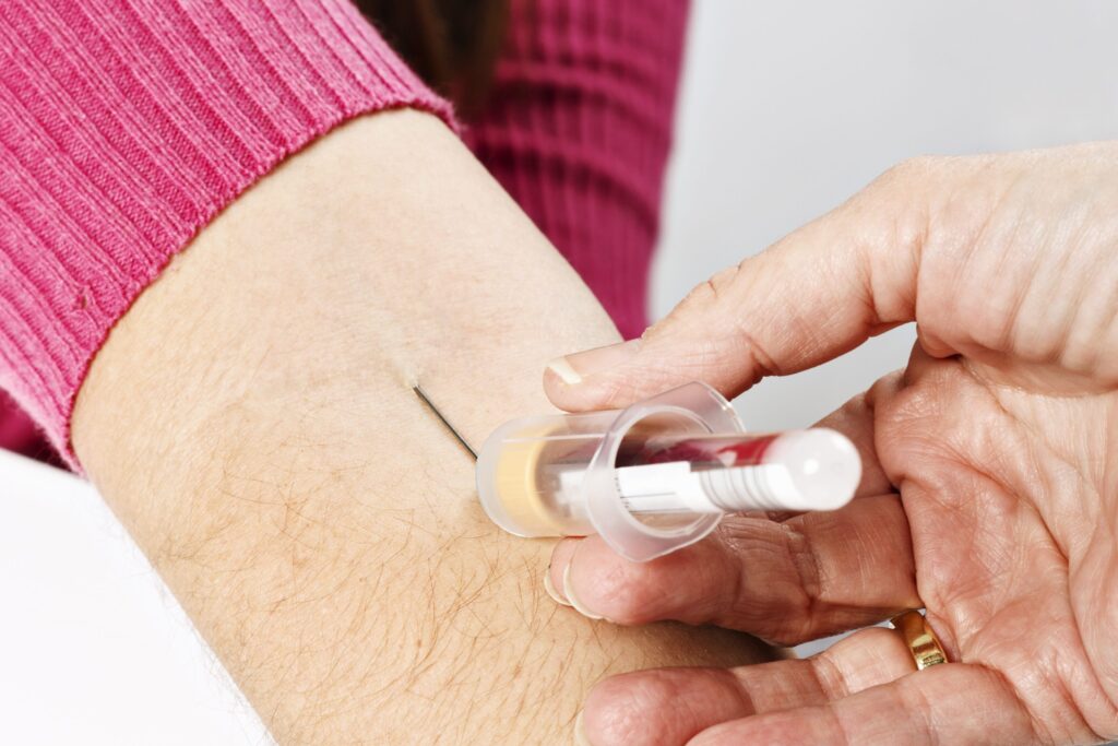 Acidose hyperchlorémique : comprendre ses causes et ses traitements