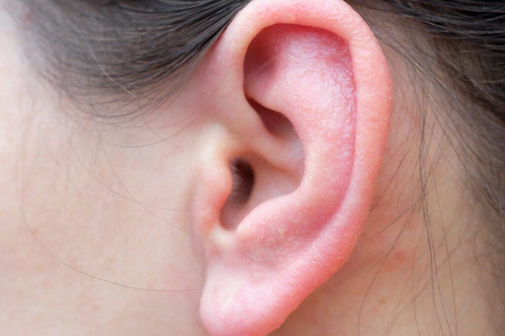 Exostose de l’oreille : comment la reconnaître et la traiter ?