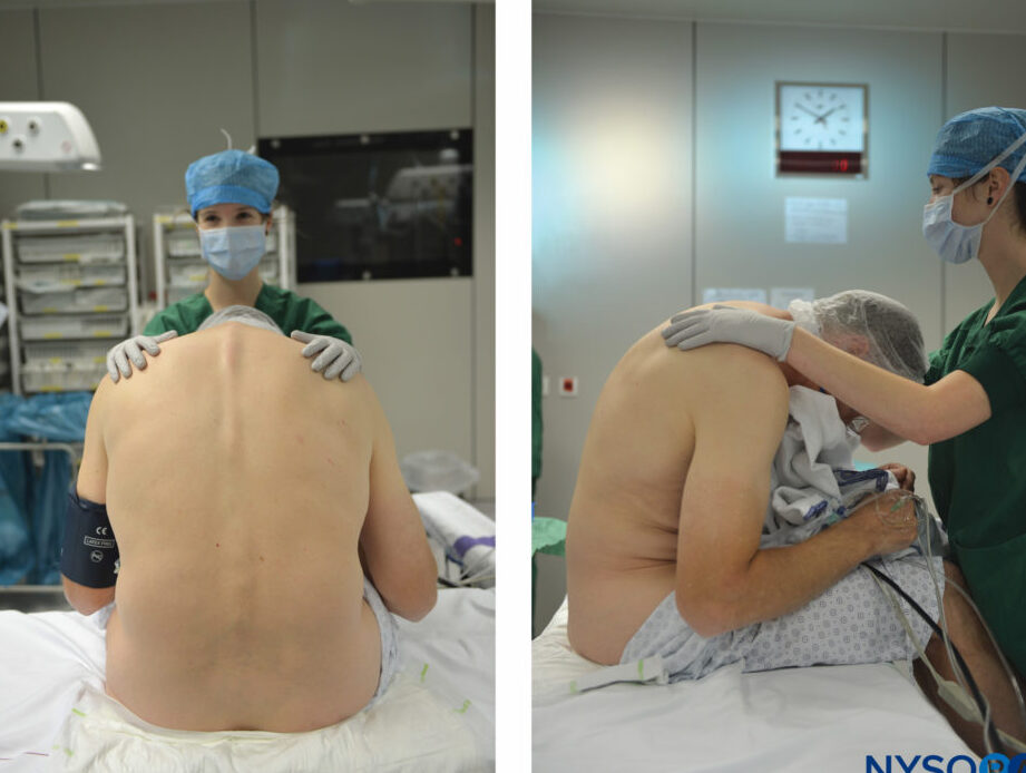 Pourquoi le réflexe cutané abdominal est-il un indicateur clé de votre santé neurologique ?