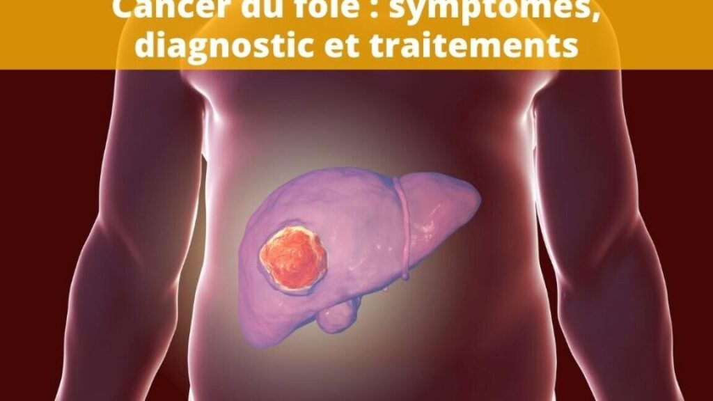 Comment reconnaître les signes d&rsquo;une insuffisance hépato-cellulaire ?