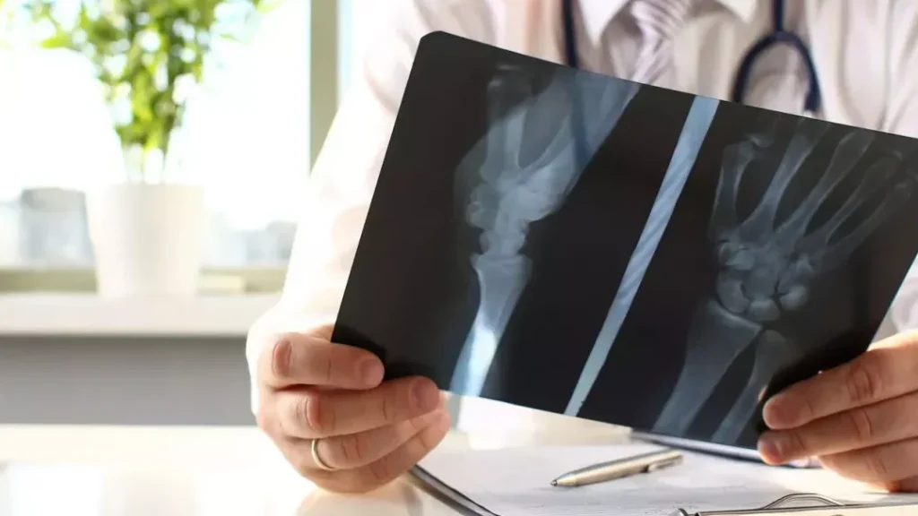 Fracture du métatarse : comment reconnaissez-vous les signes et quelles sont les étapes de guérison ?