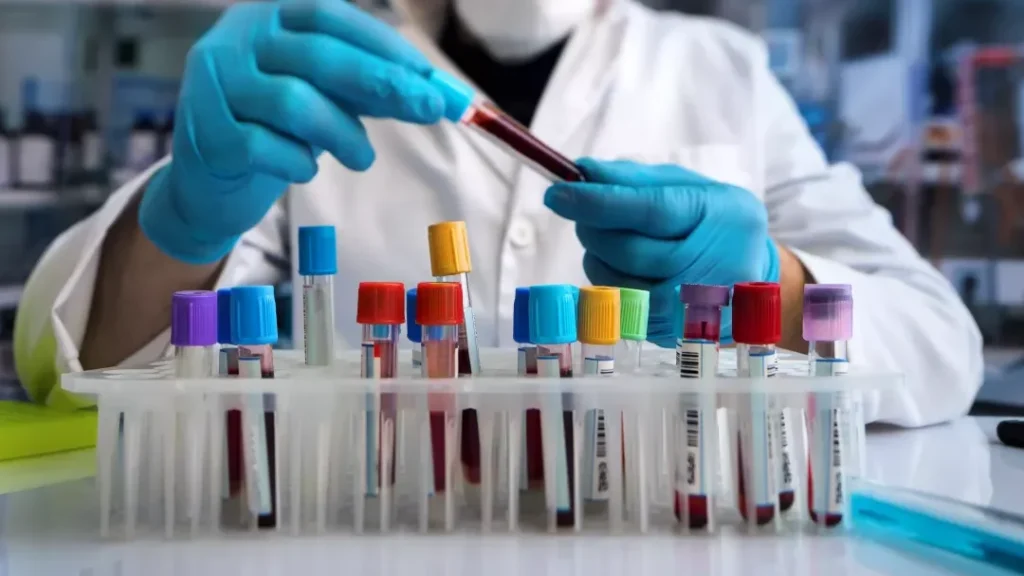 Comprendre le test direct à l’antiglobuline : quelles indications et quels résultats attendre ?