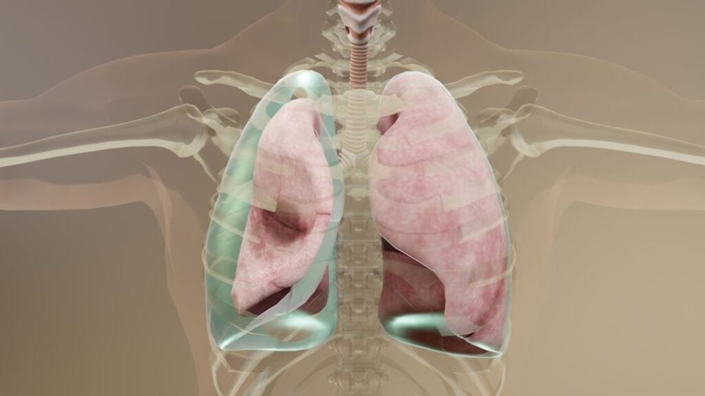 Comprendre et gérer le pneumothorax chez le nouveau-né : Symptômes, causes et traitements