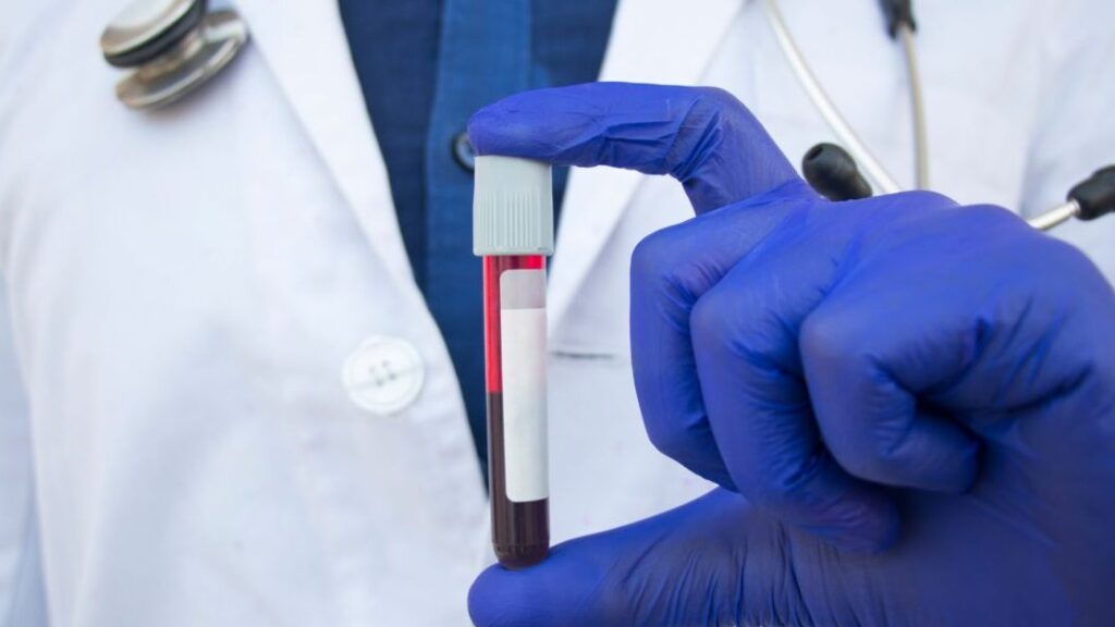 Alcalose métabolique de contraction : comment la reconnaître et la traiter ?