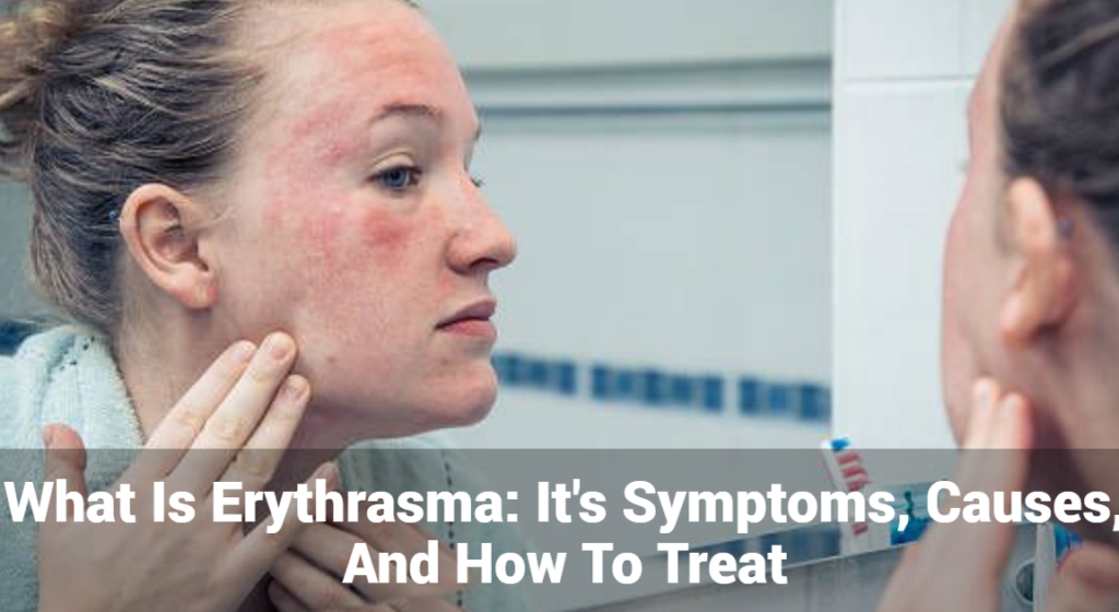 Erythrasma : quel est le traitement le plus efficace pour combattre cette infection cutanée ?
