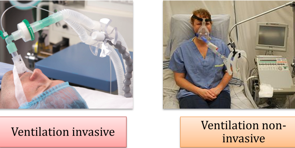 Ventilation respiratoire : comprendre son importance pour votre santé pulmonaire