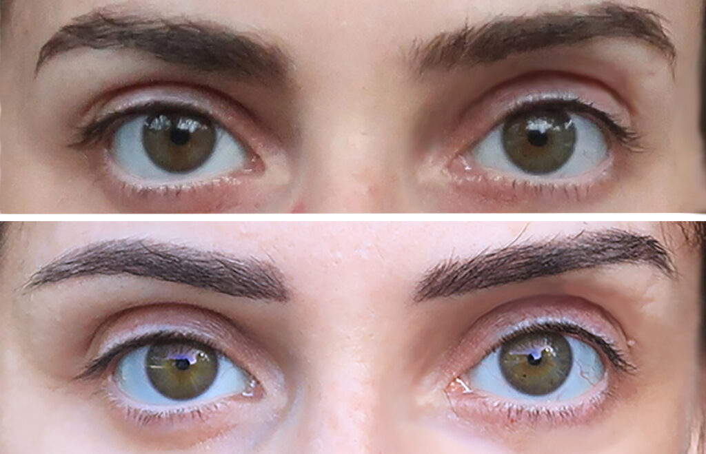 Avant-après microshading des sourcils : résultats naturels et durabilité de la dermopigmentation.