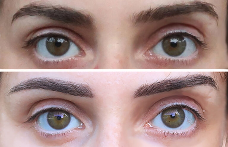 Avant-après microshading des sourcils : résultats naturels et durabilité de la dermopigmentation.