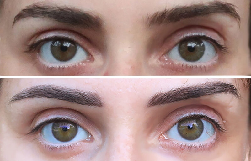 Avant-après microshading des sourcils : résultats naturels et durabilité de la dermopigmentation.