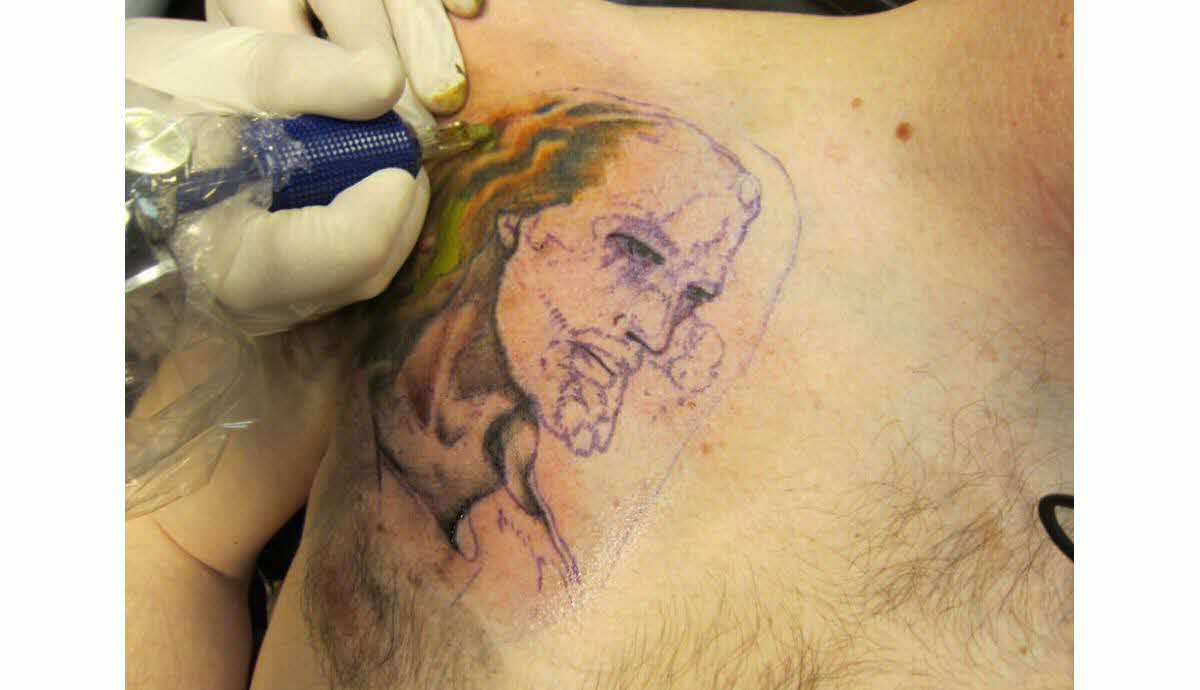 Tatouage infecté après baignade