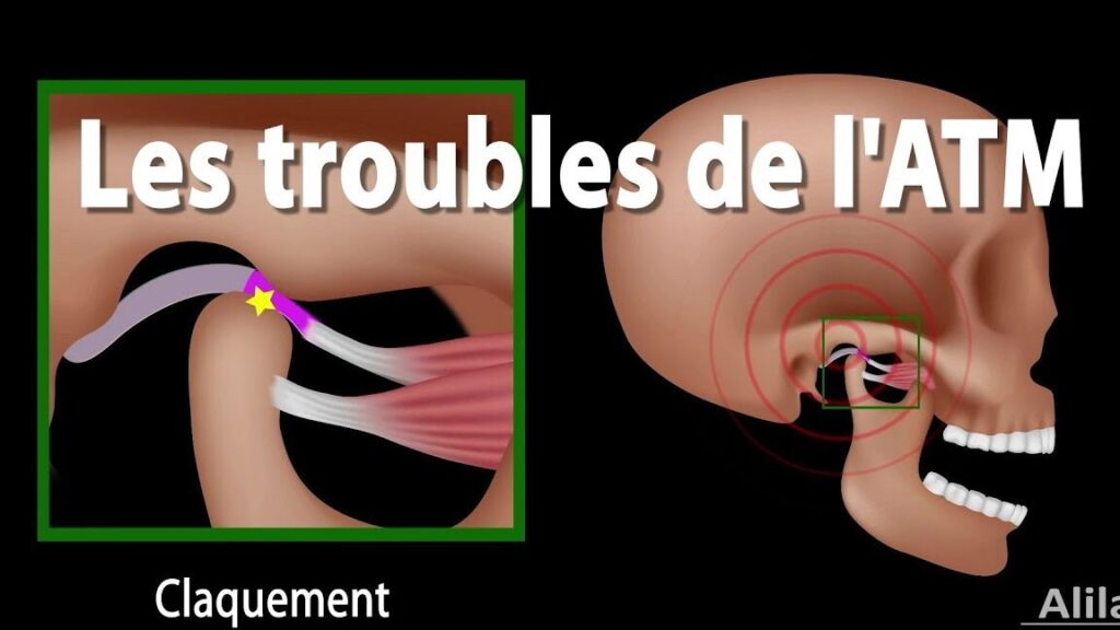 Luxation de la mâchoire : quels sont les symptômes à surveiller ?