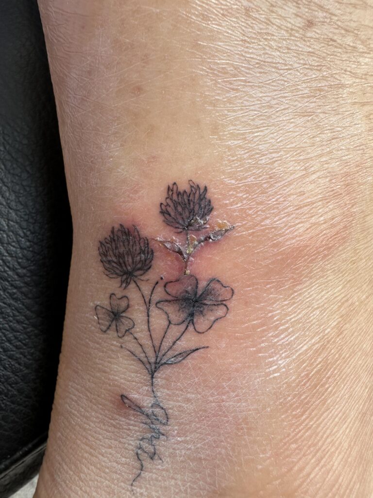Tatouage infecté avec rougeurs et gonflements, signes d'une possible infection cutanée