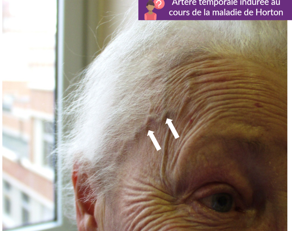 Claudication de la mâchoire : quelles en sont les causes et comment y remédier ?