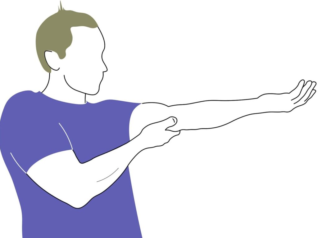 Comment apaiser la douleur liée au nerf radial ?