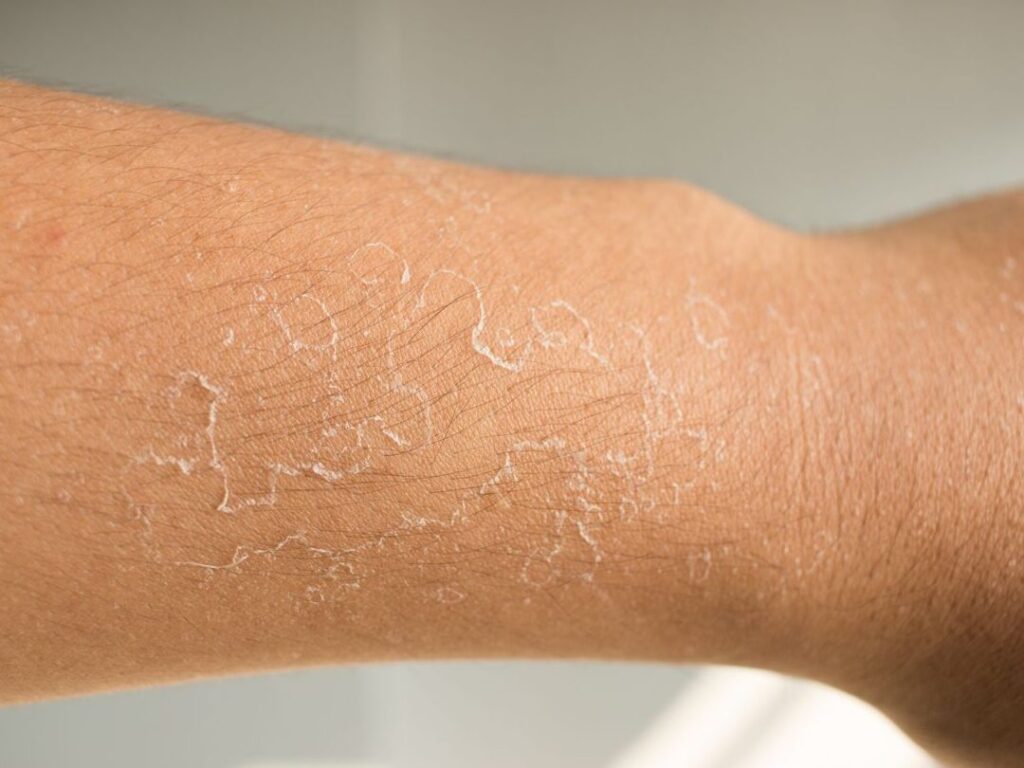 Comprendre la coupe de la peau : quels impacts pour votre santé cutanée ?