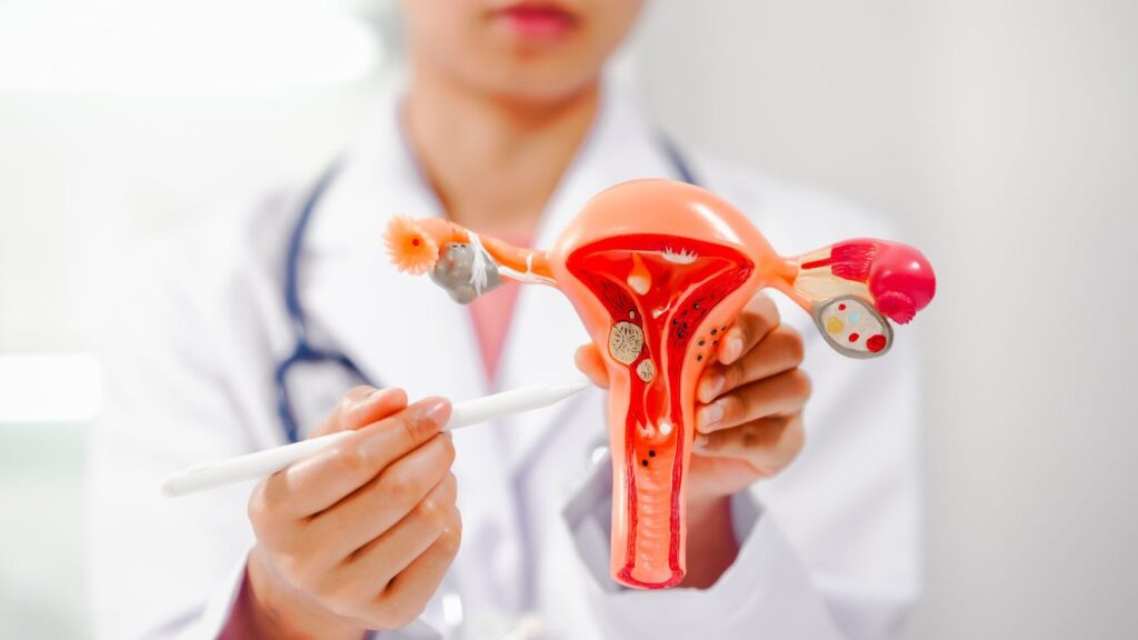 Masse pelvienne suspecte : est-ce forcément un signe de cancer ?