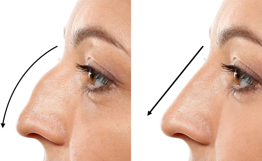 Boule de cartilage dans le nez : qu’est-ce que cela signifie pour votre santé ?