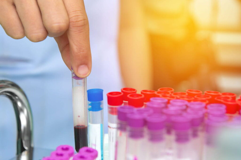 Fausses polyglobulies : que signifie ce diagnostic pour votre santé ?