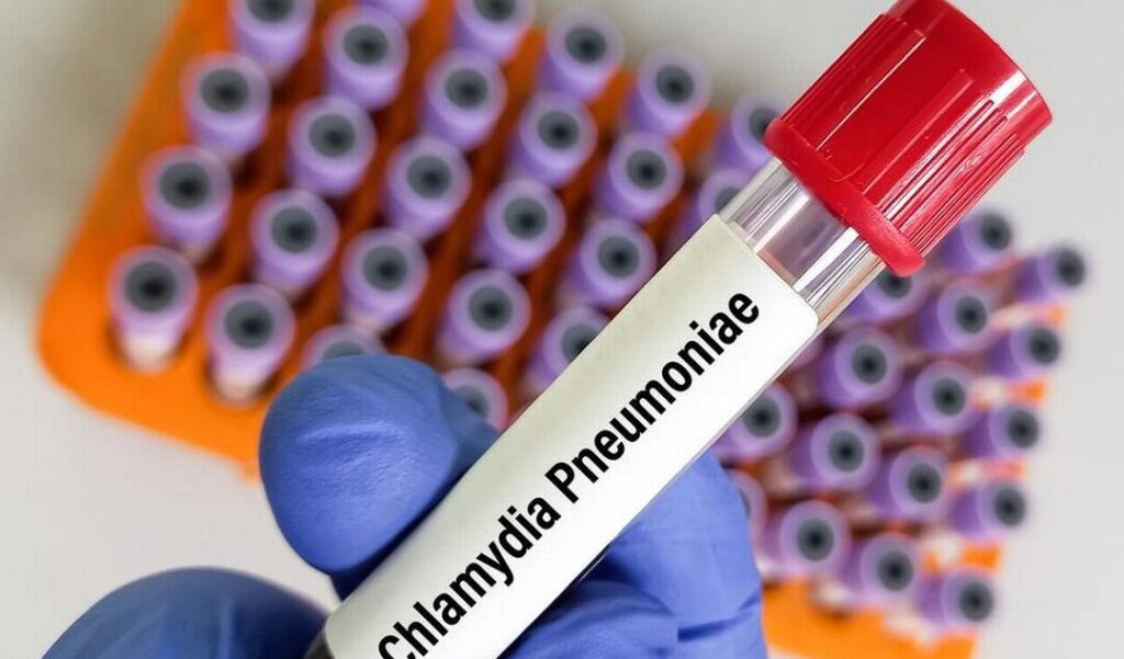 Chlamydia pneumoniae : symptômes, traitement et prévention