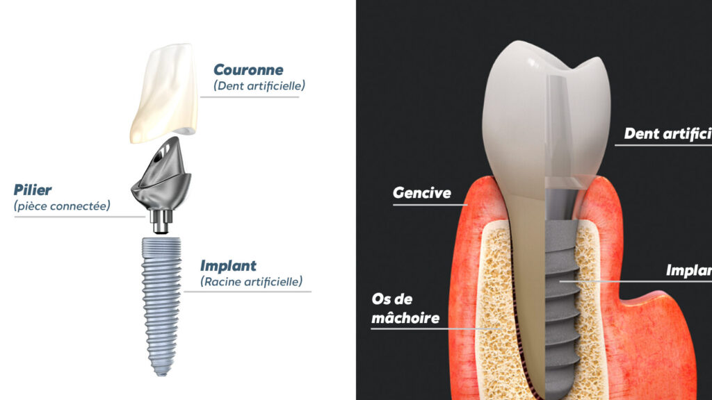 Comprendre l&rsquo;anatomie des dents : quels rôles pour chaque type de dent ?