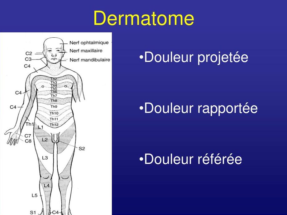Dermatome : comprendre son rôle dans les diagnostics de douleur et de sensation